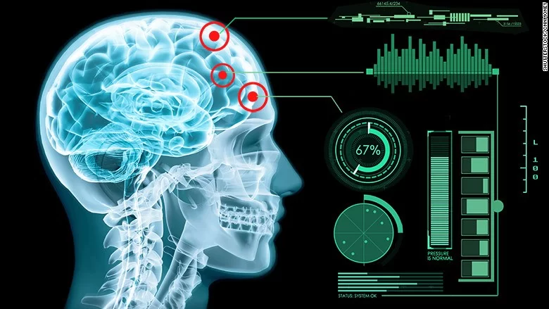 Brain Computer Interface: NEURALINK