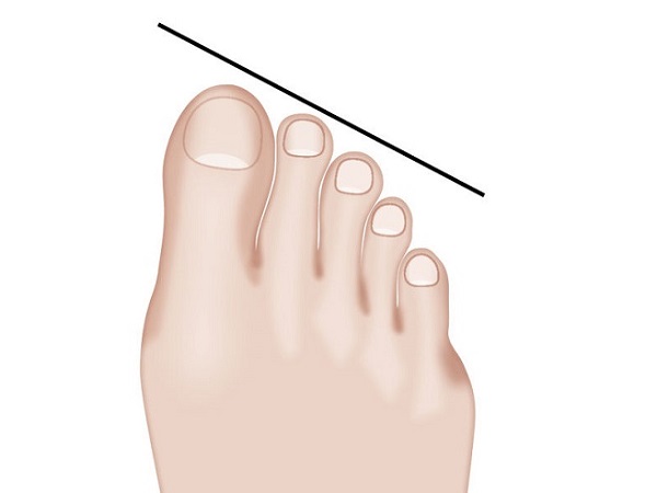 Egyptian toe